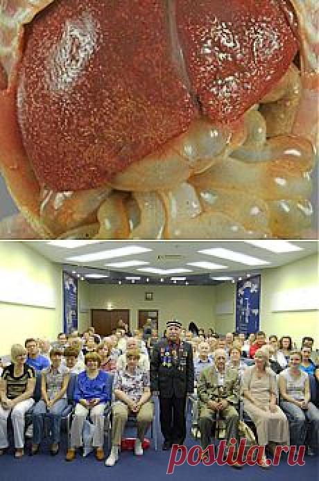 Как полностью очистить печень