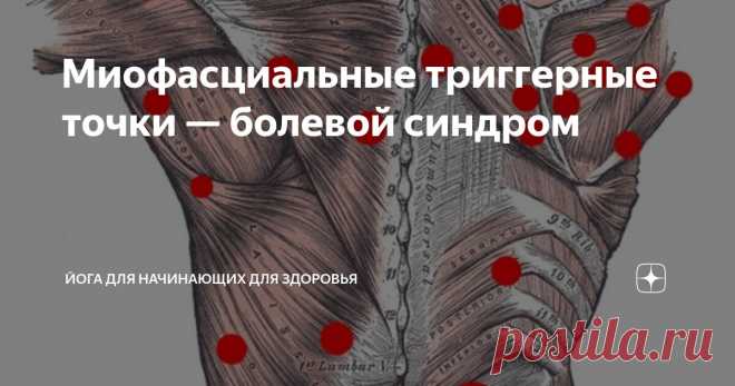 Миофасциальные триггерные точки — болевой синдром Статья автора «Йога для начинающих для здоровья» в Дзене ✍:   Миофасциальный болевой синдром (МПС) — это хроническое болевое расстройство, характеризующееся воспалением и болезненностью в фасции,...