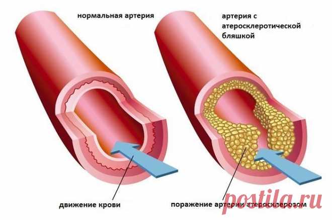 ТОП-8 продуктов, которые очищают сосуды! Избавь себя и близких от серьезной проблемы. Проблема заболеваний сердечно-сосудистой системы затрагивает тех, кто переступил рубеж среднего возраста. Вредные привычки, нерациональное питание, ежедневные стрессы и плохая экология пагубно сказыва…