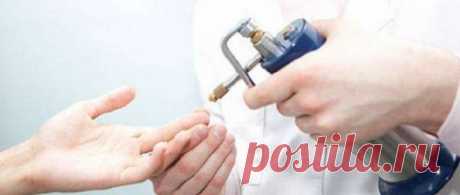 Удаление папиллом жидким азотом: показания и противопоказания