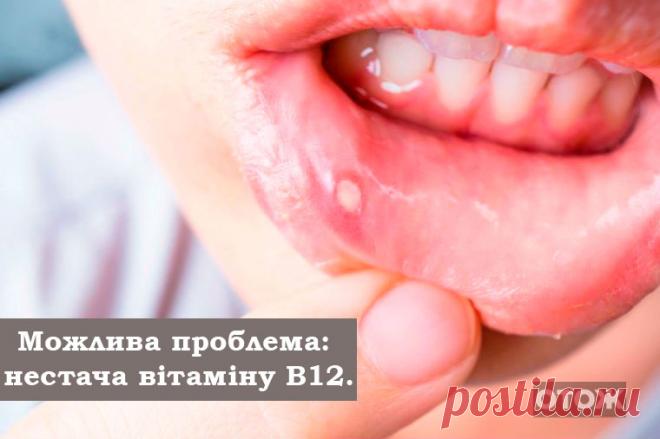 Не всі хвороби лікуються ножем! 10 ознак, що вашому тілу дуже не вистачає вітамінів | ОТОЖ
