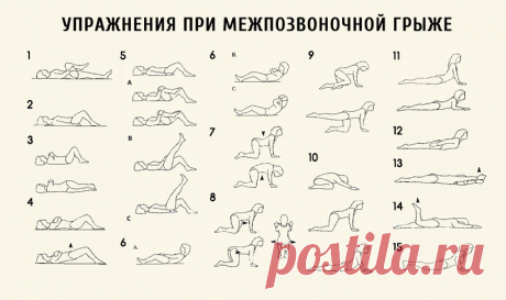Лeчебная физкультура при протрузии и грыже