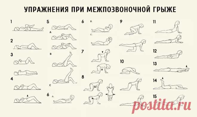 Лeчебная физкультура при протрузии и грыже