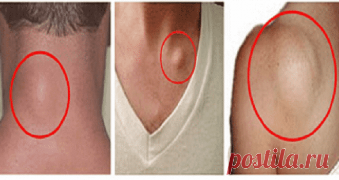 Быстрое и простое удаление жировой ткани совершенно естественным способом — Жизнь под Лампой!