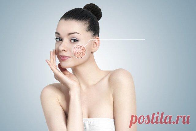 Почему на коже появляются сосудистые звездочки, и как от них избавиться? Сосудистые звездочки на коже лица способны ухудшить настроение любой женщине. Что представляет собой купероз и как избавиться от болезни?