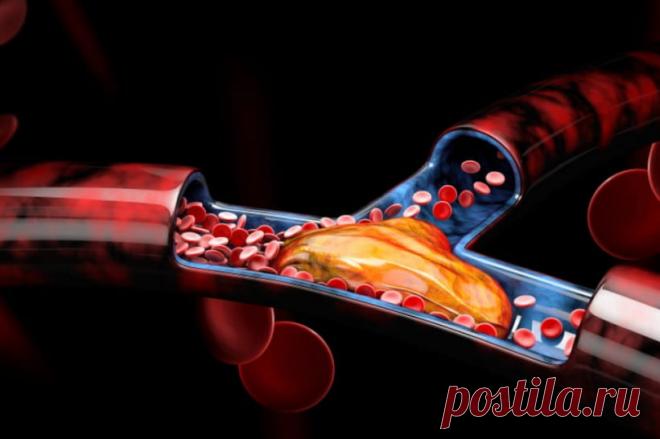 Медики назвали ранні симптоми утворення тромбів після вакцинації