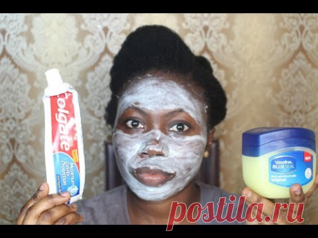 I APPLIED COLGATE TOOTHPASTE & VASELINE ON MY FACE, THIS IS WHAT HAPPENED AFTER