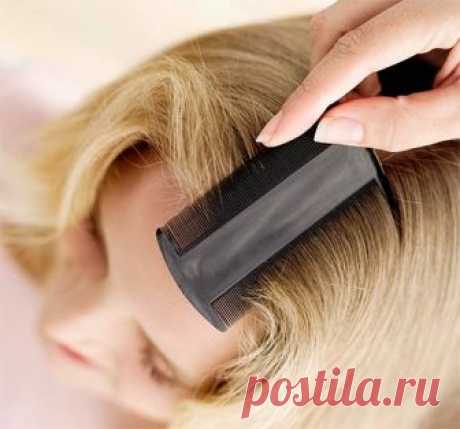 Как избавиться от вшей и гнид - лечение в домашних условиях