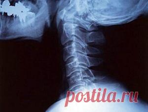 Лечение межпозвоночной грыжи шейного отдела позвоночника - в чем сложность?