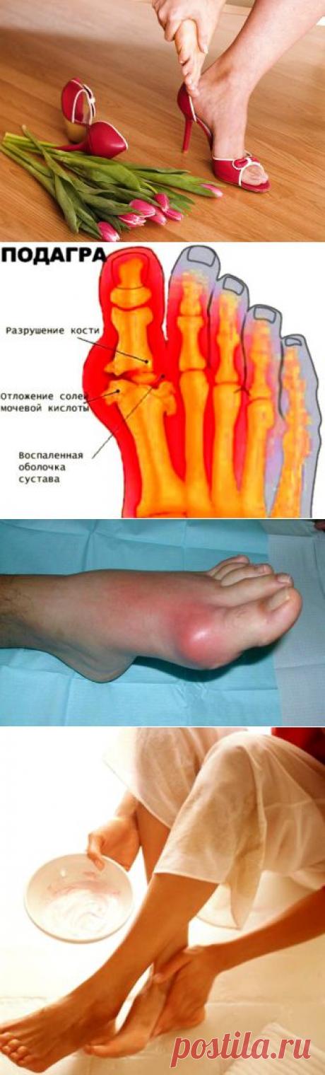 (+1) тема - Домашнее лечение подагры | ВСЕГДА В ФОРМЕ!