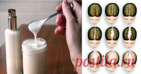 Shampoo de Bicarbonato de Sódio vai Fazer seu Cabelo Crescer