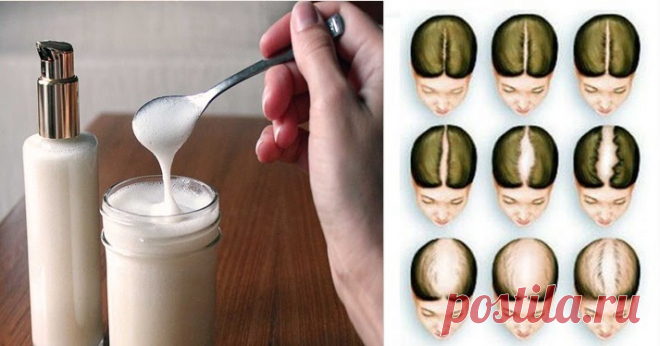 Shampoo de Bicarbonato de Sódio vai Fazer seu Cabelo Crescer
