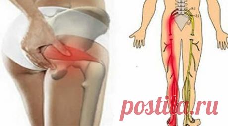 1 простое 5минутное упражнение избавит от боли от воспаления седалищного нерва! Это упражнение очень полезно и часто используется для такого лечения. Седалищный нерв является самым длинным в человеческом теле. Его воспаление вызывает сильную боль, которая простирается от ребер до колен. Когда мы страдаем от проблемы воспаления в седалищном нерве, боли абсолютно ужасны. Многие люди чувствуют боль настолько глубокую и сильную, что даже не могут стоять. В дополнение к боли мо...