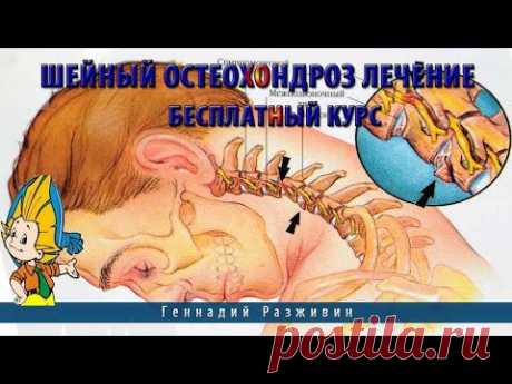Шейный остеохондроз лечение Бесплатный курс - YouTube