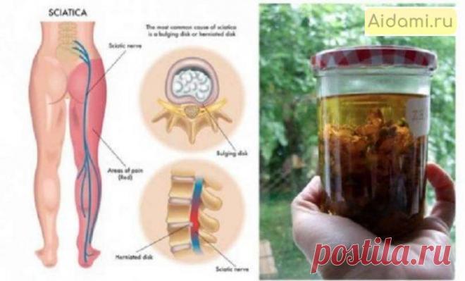 Лечите боль седалищного нерва без лекарств: 4 мощные травы | АйДаМы | У нас Всегда лучшее