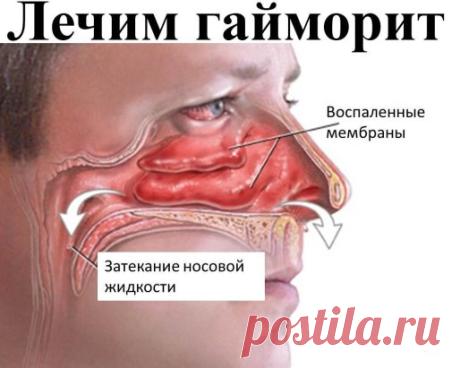 Лечим за копейки гайморит и не только!
В это сложно поверить! Так и не попробовала бы его если бы здоровье не подвело и мама под руку не поставила. Л
Вообще Меновазин ассоциировался у меня с чем-то древним и бесполезным и я никогда бы не поверила что он может творить чудеса, если бы сама не столкнулась с ним.
Я даже не обратила внимание на восторги моей мамы. Она растирала суставы Меновазином и боль прошла, хотя до этого использовала дорогие мази которые давали кратковреме...