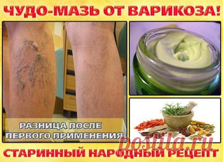 Рецепт от известной ведущей.Избавьтесь от отеков и варикозных вен без усилий и траты денег! В домашних условиях, всего за неделю ваши ножки обретут здоровье и красоту! Узнайте подробности излечения от варикоза►► https://mltop.net/d85e964pwm