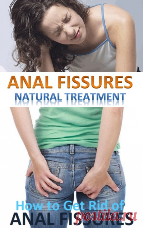 Home Remedies for Anal Fissures | Virtual Clinic