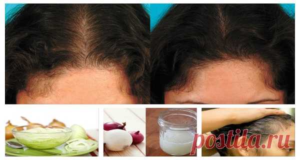 Por qué el jugo de cebolla es extremadamente beneficioso para el crecimiento del cabello &#8211; Hoy En Belleza