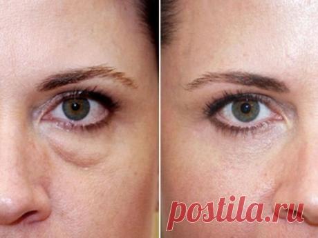 Спасаемся от мешков под глазами
Традиционное средство от интоксикации Энтеросгель способно спасти вашу внешность после бурной вечеринки. С медицинской точки зрения отек под глазами — это вода, которая «застряла» в жировой прослойке век.
Чтобы этого не случилось, перед сном нанесите под глаза слой энтеросгеля. Пока вы спите, гель заберёт излишки влаги, и с утра вас ждет гораздо более радостная картина. Важно: гель обезвоживает кожу, поэтому сразу после утреннего умывания нанесите увлажняющий кр