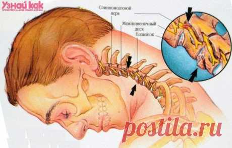 Если болит шея. * Помогает массирование подушечками указательных пальцев двух точек, расположенных на задней стороне шеи в 5-6 см по обе стороны от позвоночника непосредственно под основанием черепа (около 3 см за мочкой уха) в течении 1-2 мин.
