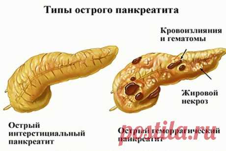 ЛЕЧЕБНЫЕ ТРАВЫ- Лечение народной медициной | ЗОЖ