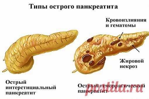 ЛЕЧЕБНЫЕ ТРАВЫ- Лечение народной медициной | ЗОЖ