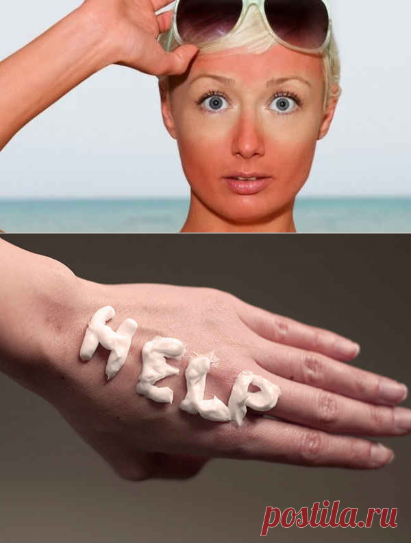 Что делать при солнечном ожоге. Лечение зуда, волдырей, отека