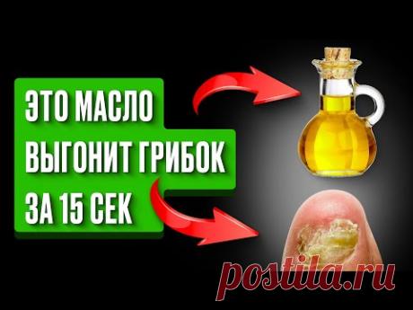 Как я навсегда избавилась от ГРИБКА НОГТЕЙ простым… за 15 сек? Это МАСЛО есть у каждого