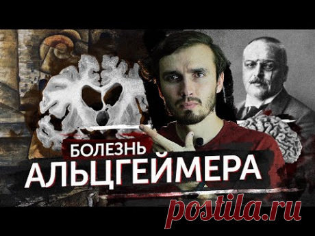 Болезнь Альцгеймера - [История Медицины]