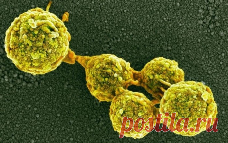 Увы, такова горькая правда: нас едят грибы