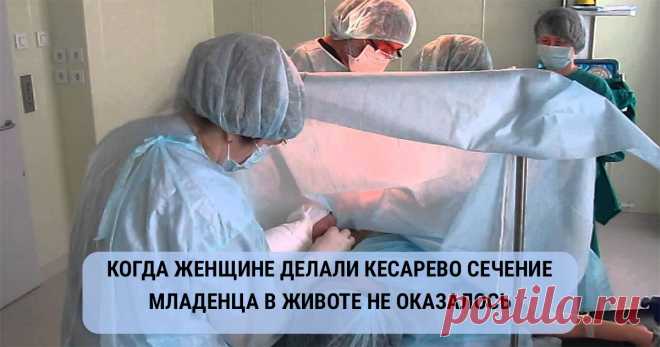 Когда беременной женщине делали кесарево сечение, вот что оказалось у неё в животе!! | IQFormat Удивительная история случилась в семействе Хьюз. Когда беременной женщине делали кесарево сечение, младенца в животе не оказалось!