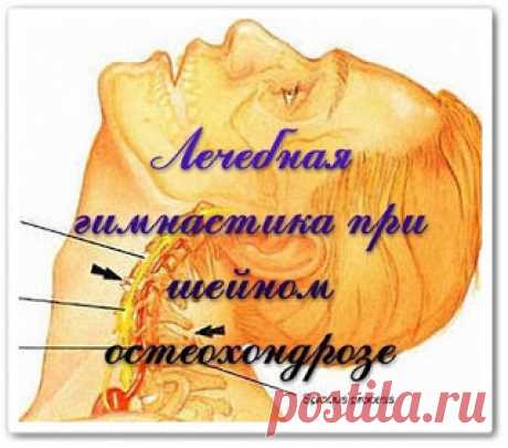 Упражнения при шейном остеохондрозе (видеоурок)