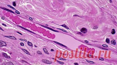 Трансфузиолог Трахтман назвал ключом к долголетию сохранение густой сети капилляров. Эксперт проекта о донорстве крови и плазмы «+Я», заведующий отделением трансфузиологии Детского медицинского центра имени Дмитрия Рогачёва Павел Трахтман выразил мнение, что сохранение густой сети капилляров — это ключ к долголетию. Читать далее