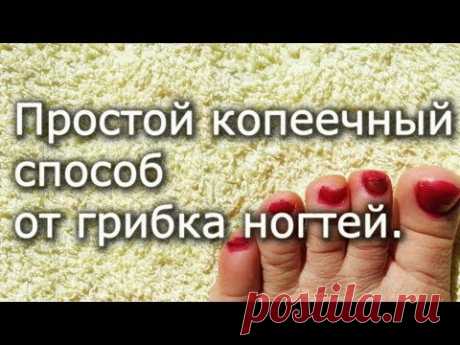 Простой копеечный способ от грибка ногтей.