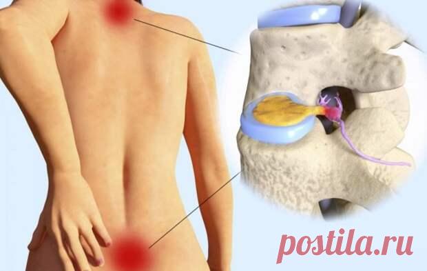 Секрет боли в спине у вас в ногах. 10 упражнений, которые исправят все - Хитрости Жизни - медиаплатформа МирТесен Боль в спине — серьезная проблема, которая затрагивает миллионы людей во всем мире. Это чаще всего вызвано травмами, неправильной осанкой или сидением в течение длительного периода. Боль в спине может варьироваться от легкой до тяжелой, а позднее серьезно мешать вашему образу жизни и повседневной