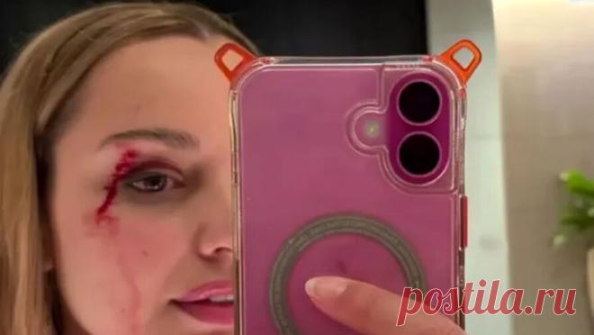 Птица атаковала журналистку и рассекла ей лицо во время съемок репортажа. Птица ударила девушку-репортера по лицу во время уличной съемки в Новой Зеландии. Об этом пишет газета Metro. Джесс Тайсон, бывшая Мисс Новая Зеландия и репортер телеканала Māori TV, была атакована птицей, когда снимала сюжет для ...