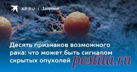 Десять признаков возможного рака: что может быть сигналом скрытых опухолей Академик РАН Оксана Драпкина перечислила признаки скрытого рака