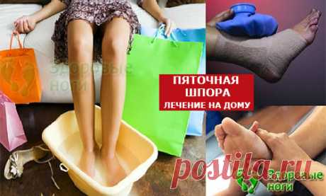 Топ-10 методов лечения пяточной шпоры в домашних условиях. Проверенные рецепты, как вылечить пяточную шпору на дому