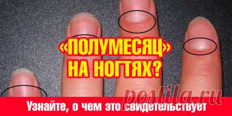 Есть ли у Вас так называемый «полумесяц» на ногтях? Узнайте, о чем это свидетельствует | Полезные советы