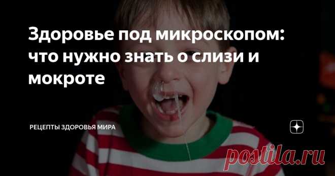 Здоровье под микроскопом: что нужно знать о слизи и мокроте Статья автора «Рецепты здоровья мира       » в Дзене ✍: Мы вспоминаем о слизи только тогда, когда она становится ненормальной и вырывается из наших тел в виде липких выделений.