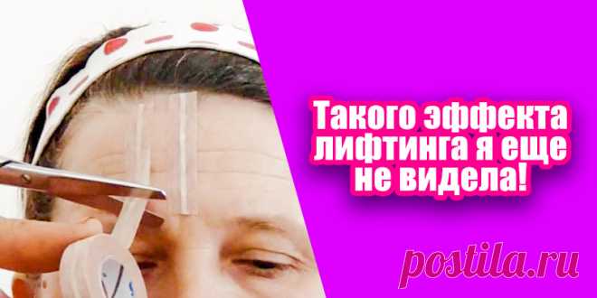 Женщине наклеили на лоб несколько полосок из фольги. Такого эффекта лифтинга я еще не видела! | Полезные советы