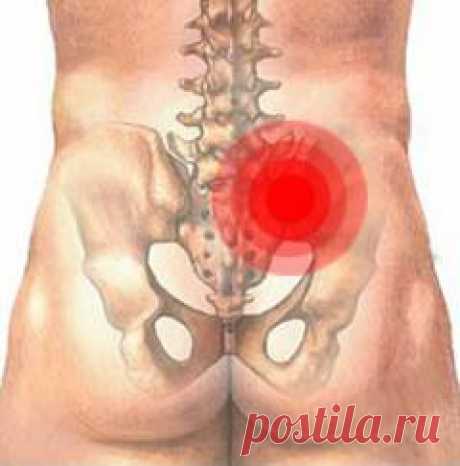 Сакроилеит. Причины, симптомы, виды, лечение и реабилитация :: Polismed.com