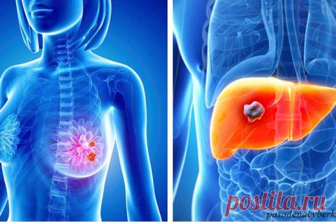 Вот те симптомы рака, которые появляются за 2-5 лет до самой болезни Ранняя диагностика онкологических заболеваний повышает шансы на успешное лечение, пишет Bestie. Однако на начальных этапах рак может никак себя не проявлять. Человек чувствует себя здоровым и даже бодрым. Как же определить, что он развивается и вскоре может перерасти в серьезную проблему? Вот несколько самых распространенных видов рака и их ранние признаки: 1. Рак легких и […]