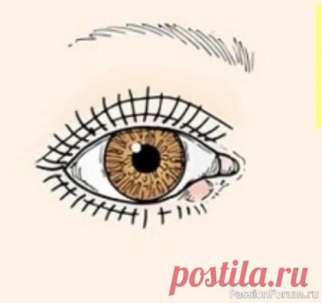 Быстрое лечение ЯЧМЕНЯ на глазу — 4 рецепта 1. Цветки ромашки (1 ст.л.) залить кипятком (200мл). Настой накрыть и оставить на полчаса. Использовать для промывания больного глаза;2. Семена льна подержать на сухой сковороде и пересыпать в мешочек из натуральной ткани (лучше хлопковой). Использовать, как сухое тепло в начале болезни;...