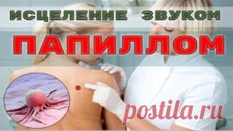 КВАНТОВОЕ ИСЦЕЛЕНИЕ КОЖИ ОТ ПАПИЛЛОМ🎇ИСЦЕЛЕНИЕ ЗВУКОМ (д-р РАЙФ)