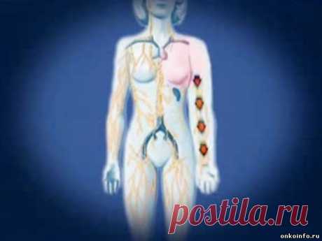 Лечение лимфостаза...