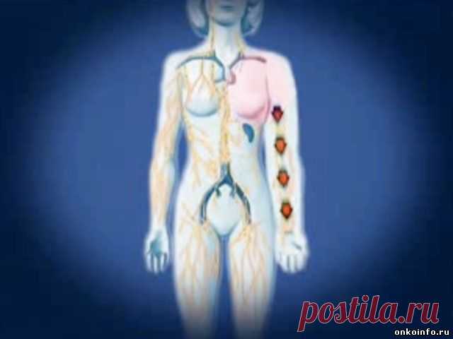 Лечение лимфостаза...