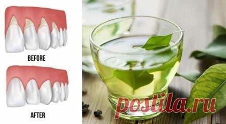 4 народных средства при рецессии десны!