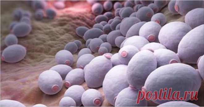 Кандида: грибок внутри нас — продукты, которые нужно избегать